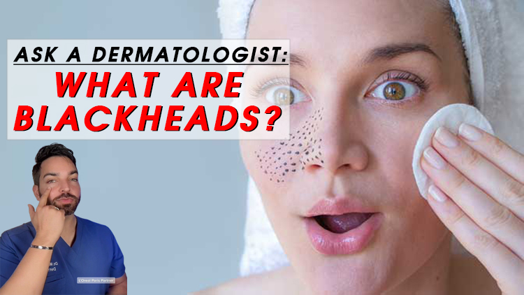 Ask a Dermatologist: What Are Blackheads?