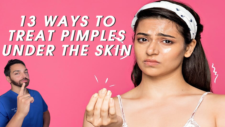 13 Ways to Treat Pimples Under the Skin, According to Dermatologists