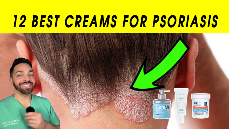 12 Best Creams for Psoriasis in 2023