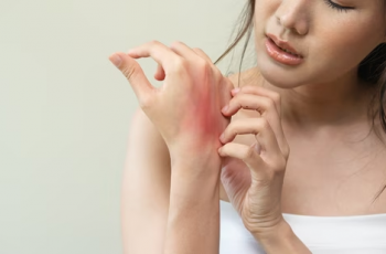 Itchy Skin? Here’s Everything to Know About Eczema